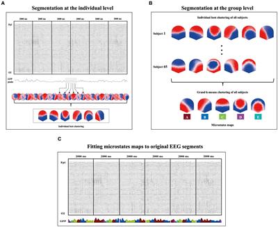 Cardiorespiratory fitness modulates prestimulus EEG microstates during a sustained attention task